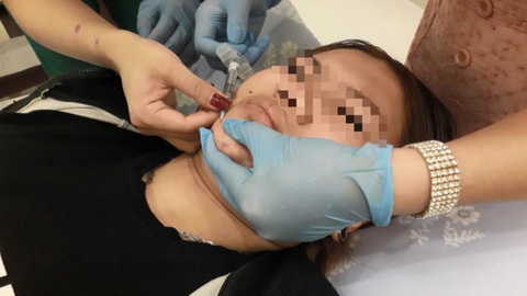 Vào ‘Xinh Beauty & Academy’ tiêm chất làm đầy, cô gái 39 tuổi mờ mắt - Ảnh 1. Ngày càng nhiều "tay ngang" làm đẹp. Có nhiều nạn nhân tiêm chất làm đầy bị biến chứng mù mắt hoặc đột quỵ - Ảnh: T.L.