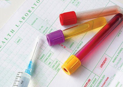 Xét nghiệm nội tiết tố nữ được chỉ đinh khi bác sĩ phát hiện có bất thường nội tiết - Ảnh minh họa Xét nghiệm nội tiết tố nữ được chỉ định khi bác sĩ phát hiện bất thường nội tiết - Ảnh minh họa
