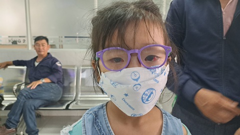 TP.HCM: Nhiều trẻ đau mắt đỏ kèm xuất huyết, làm sao không bị lây? - Ảnh 1. Bé Trần Phương Thảo bị viêm giác mạc dạng xuất huyết - Ảnh: N.T.