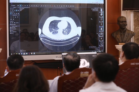 Các bác sĩ bệnh viện Bạch Mai hội chẩn toàn viện về các nạn nhân trong vụ cháy trong sáng 13-9 - Ảnh: TTXVN Các bác sĩ bệnh viện Bạch Mai hội chẩn toàn viện về các nạn nhân trong vụ cháy trong sáng 13-9 - Ảnh: TTXVN