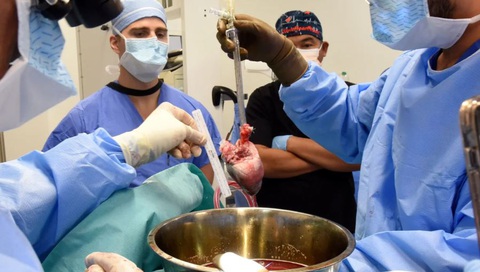 Qủa tim heo được ghép cho ông Lawrence Faucette - Ảnh: Deborah Kotz/University of Maryland School of Medicine/AP Quả tim heo được ghép cho ông Lawrence Faucette - Ảnh: Deborah Kotz/University of Maryland School of Medicine/AP