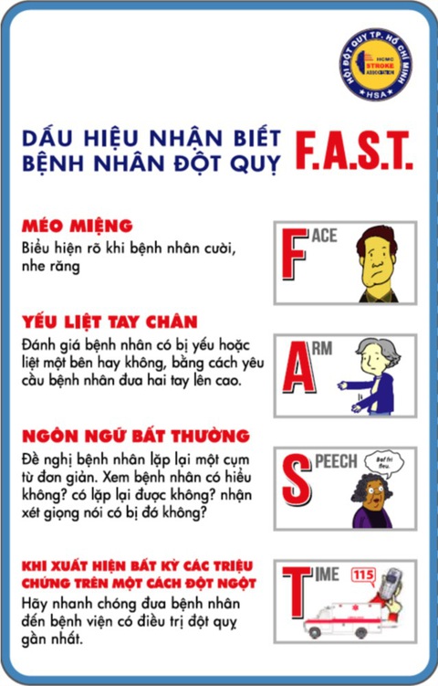 Bất ngờ thấy người bị đột quỵ, bạn đã xử trí đúng cách? - Ảnh 3. Dấu hiệu nhận biết bệnh nhân đột quỵ - Ảnh: Hội Đột quỵ TP.HCM cung cấp