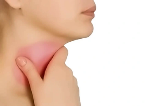 Tổng cộng có trên 600 hạch bạch huyết trong cơ thể - Ảnh minh họa Tổng cộng có trên 600 hạch bạch huyết trong cơ thể - Ảnh minh họa
