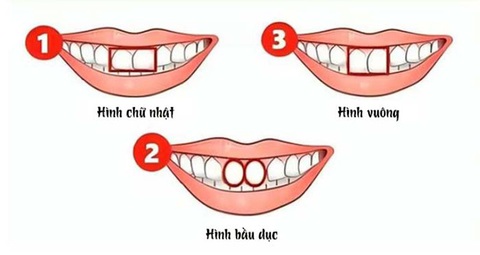 Hình dạng răng cửa nói gì về bạn? - Ảnh 1. Hình dạng răng cửa nói gì về bạn? - Ảnh 1.