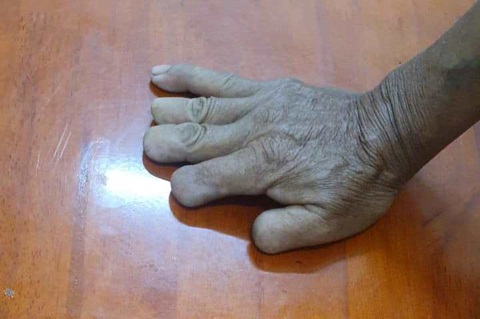 Bị can giết 6 người nói: 43 năm nghĩ không bao giờ tìm ra tôi, vậy mà tôi vẫn bị bắt- Ảnh 3. Bàn tay phải cụt bón ngón là đặc điểm nhận dạng dễ nhận biết nhất của bị can Phan Thanh Việt - Ảnh: Công an Quảng Ngãi