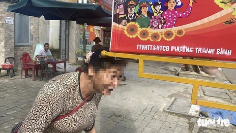 Làm trụ treo pa nô gây nguy hiểm ở Đà Nẵng: Các phường hứa rà soát- Ảnh 2. Một người dân mô tả với phóng viên những lần bị va chạm với trụ treo pa nô lắp thấp - Ảnh: TRƯỜNG TRUNG