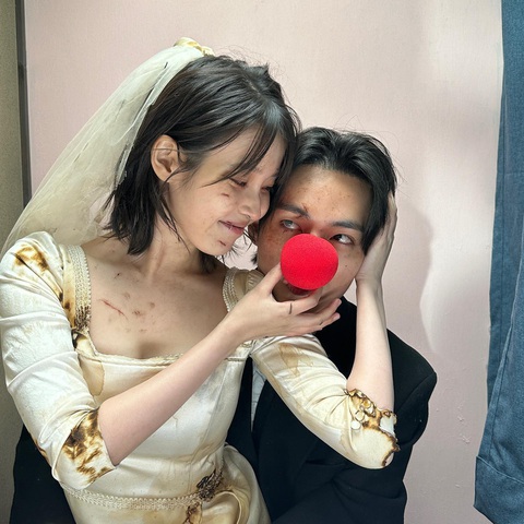 'Thả thính' bằng loạt ảnh bầm giập, IU và V (BTS) vẫn gây sốt- Ảnh 2. Dù trang phục ố màu, nhàu nát và gương mặt chằng chịt những vết bầm tím, sẹo nhưng V và IU đều vui vẻ, tương tác cực ăn ý
