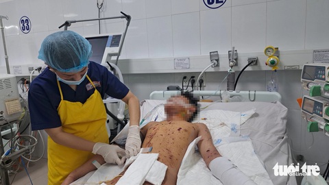 Bé trai 12 tuổi bị giập nát tay chân, vỡ ruột non vì chơi pháo nổ- Ảnh 1. Bệnh nhân P. (12 tuổi) bị thương nặng do chơi pháo nổ - Ảnh: Đ.N.