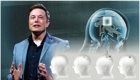 Telepathy bao gồm một con chip máy tính nhỏ được gắn vào những sợi chỉ linh hoạt nhỏ xíu và được một con robot có chức năng tương tự máy khâu khâu vào não người - Đồ họa, ảnh: SINGULARITY HUB, MASHABLE ME Telepathy bao gồm một con chip máy tính nhỏ được gắn vào những sợi chỉ linh hoạt nhỏ xíu và được một con robot có chức năng tương tự máy khâu khâu vào não người - Đồ họa, ảnh: SINGULARITY HUB, MASHABLE ME