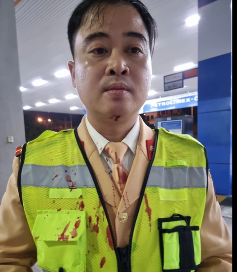 Tài xế dương tính với ma túy đá, tông ngã cảnh sát giao thông- Ảnh 2. Cảnh sát giao thông bị tài xế tông trúng - Ảnh: Công an cung cấp