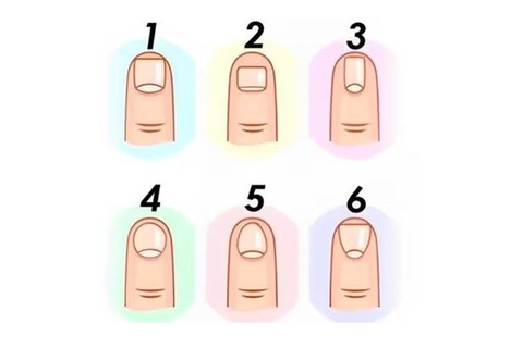 Hình dạng móng tay tiết lộ tính cách bí ẩn của bạn- Ảnh 1. Hình dạng móng tay tiết lộ tính cách bí ẩn của bạn- Ảnh 1.