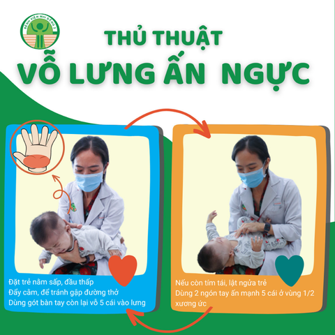 Trẻ mắc dị vật đường thở, phụ huynh cần xử lý sao?- Ảnh 3. Bác sĩ Bệnh viện Nhi đồng 2 (TP.HCM) hướng dẫn xử lý tình huống trẻ dưới 2 tuổi mắc dị vật - Ảnh: Bệnh viện cung cấp