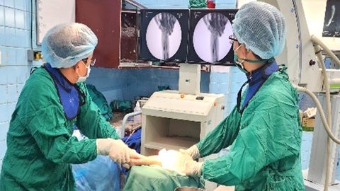 Cảnh báo trẻ bị tai nạn gia tăng- Ảnh 1. Các bác sĩ Bệnh viện Chấn thương chỉnh hình nối lại cánh tay cho một bé gái 5 tuổi - Ảnh: BVCC
