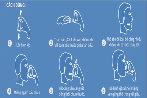 Người lớn và trẻ em đều có thể tử vong vì cơn hen phế quản- Ảnh 3. Cách sử dụng thuốc dạng xịt cho người bệnh - Ảnh: Bệnh viện cung cấp