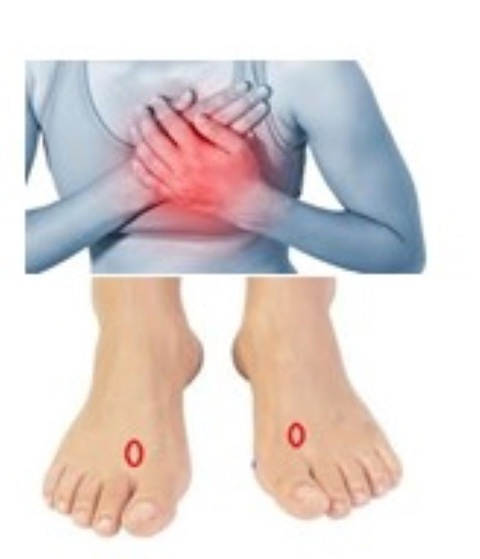 Kích thích vùng phản xạ hệ bạch huyết ở chân tăng sức đề kháng, bảo vệ cơ thể - Ảnh 3.