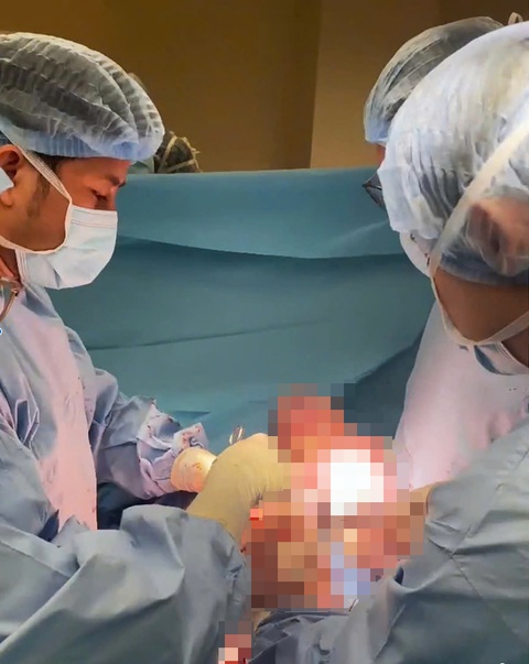 Em bé được bọc trong khối u xơ 8kg ra đời khỏe mạnh - Ảnh 1. Em bé được bọc trong khối u xơ 8kg ra đời khỏe mạnh - Ảnh 1.