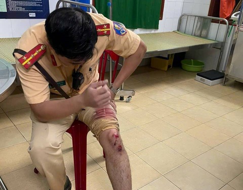 Cảnh sát tóe máu truy đuổi, bắt thanh niên mang ma túy tông xe vào tổ tuần tra - Ảnh 1.
