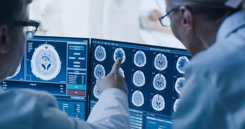 DIPG được chẩn đoán ở khoảng 300 trẻ em Mỹ mỗi năm - Ảnh: SHUTTERSTOCK DIPG được chẩn đoán ở khoảng 300 trẻ em Mỹ mỗi năm - Ảnh: SHUTTERSTOCK