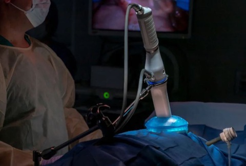 The robot could one day carry out real operations in remote locations including space (Virtual Incision) https://sg.news.yahoo.com/robot-surgeon-space-droid-space-150532194.html Trong tương lai, robot có thể thực hiện các ca mổ ở những địa điểm xa xôi, bao gồm cả không gian - Ảnh: Virtual Incision