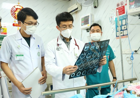PGS.TS Mai Duy Tôn (ở giữa) thăm khám cho bệnh nhân sau đột quỵ não - Ảnh: BVCC PGS.TS Mai Duy Tôn (giữa) thăm khám cho bệnh nhân sau đột quỵ não - Ảnh: BVCC