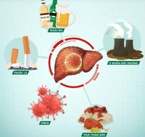 Cẩn thận hỏng gan vì thải độc- Ảnh 2. Các tác nhân gây tổn thương gan - Ảnh minh họa