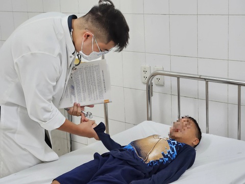 Nhiều em nhỏ ở Huế nhập viện vì đốt pháo mua trên mạng- Ảnh 1. Một bệnh nhi ở Huế nhập viện cấp cứu vì đốt pháo mua trôi nổi trên mạng - Ảnh: M.TRANG