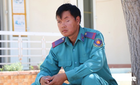 Bị hành hung đến hỏng một mắt, vẫn gắn bó với nghề bảo vệ rừng- Ảnh 1. Anh Nguyễn Nhất Chung bị lâm tặc tấn công khiến anh mất một mắt bên trái - Ảnh: DUY NGỌC