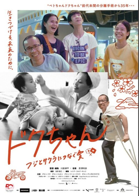 Poster bộ phim tài liệu Poster phim về người em trong ca phẫu thuật tách dính