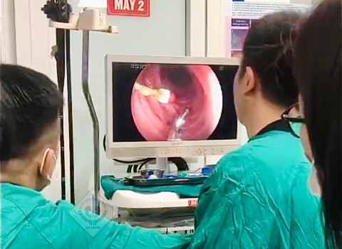 Các bác sĩ phẫu thuật nội soi lấy dị vật cho bệnh nhi - Ảnh: BVCC Các bác sĩ phẫu thuật nội soi lấy dị vật cho bệnh nhi - Ảnh: BVCC
