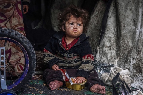 Đứa trẻ Palestine tự bốc thức ăn trong hộp tại một trại lánh nạn tạm thời ở thành phố Rafah, dải Gaza ngày 14-3. Đã có nhiều cảnh báo về nạn đói khi chiến sự ở Gaza đã kéo dài hơn 5 tháng. Ảnh: AFP Đứa trẻ Palestine tự bốc thức ăn trong hộp tại một trại lánh nạn tạm thời ở thành phố Rafah, dải Gaza ngày 14-3. Đã có nhiều cảnh báo về nạn đói khi chiến sự ở Gaza đã kéo dài hơn 5 tháng. Ảnh: AFP