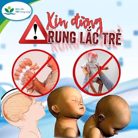 Các bác sĩ khuyến cáo cha mẹ, người thân không rung lắc trẻ - Ảnh: BVCC Các bác sĩ khuyến cáo cha mẹ, người thân không rung lắc trẻ - Ảnh: BVCC