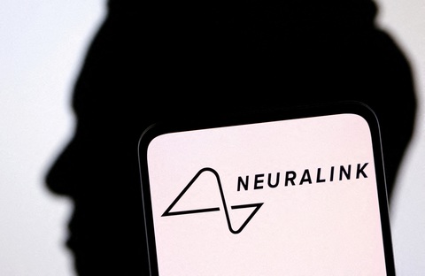 Người được cấy chip Neuralink vào não đã chơi cờ trên máy tính liên tục 8 giờ- Ảnh 1. Bệnh nhân bị liệt được cấy chip đầu tiên của Neuralink đã có thể chơi cờ trên máy tính bằng não bộ - Ảnh: REUTERS