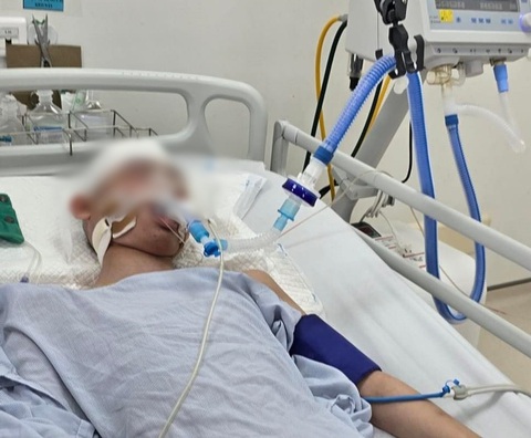 Một nam sinh lớp 8 bị người thân của bạn đánh chấn thương sọ não- Ảnh 1. Nam sinh đang được điều trị tại bệnh viện - Ảnh: Người thân nạn nhân cung cấp