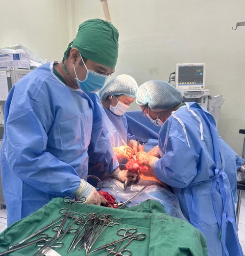 Mang khối u xơ to như thai 40 tuần mà không biết- Ảnh 1. Ê kíp phẫu thuật bóc tách khối u xơ to cho sản phụ N. - Ảnh: BV cung cấp