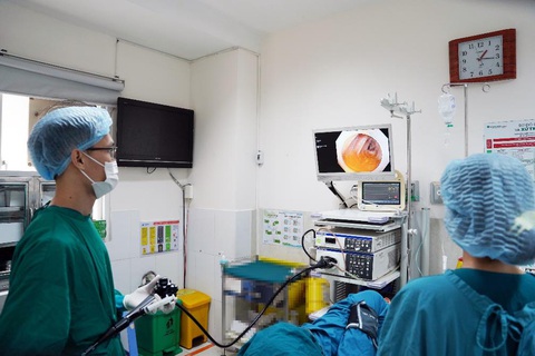 Ung thư đại trực tràng - phòng ngừa được không?- Ảnh 2. Nội soi tầm soát là phương pháp chẩn đoán phổ biến và chính xác, giúp phát hiện ung thư đại trực tràng ở giai đoạn sớm