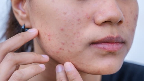 Cơ quan nghiên cứu tại Mỹ khuyến cáo một số loại mỹ phẩm chứa benzene - Ảnh minh họa: ABC News Cơ quan nghiên cứu tại Mỹ khuyến cáo một số loại mỹ phẩm chứa benzene - Ảnh minh họa: ABC News