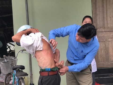 Nhiều người dân ở Thanh Hóa bị ngứa ngoài da do ký sinh trùng- Ảnh 1. Cán bộ y tế kiểm tra bệnh ngứa ngoài da trên lưng một người dân thôn Quang Biểu, xã Vĩnh Hòa, huyện Vĩnh Lộc - Ảnh: Trung tâm Kiểm soát bệnh tật tỉnh Thanh Hóa cung cấp