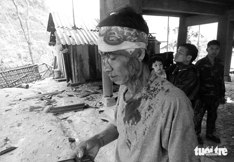 Mưa đá, lốc xoáy 'quét' bản làng, nhà sập, người dân bị thương- Ảnh 2. Ông Ốc Phò Thắng, ngụ xã Bảo Thắng, huyện Kỳ Sơn, Nghệ An, bị thương do ngói rơi trúng đầu sau mưa đá, lốc xoáy - Ảnh: TÂM PHẠM