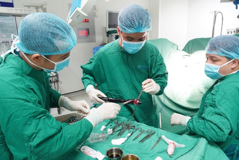 Phẫu thuật trĩ Longo: Giảm đau, ngăn tái phát, xuất viện sớm- Ảnh 2. Phẫu thuật trĩ Longo: Giảm đau, ngăn tái phát, xuất viện sớm