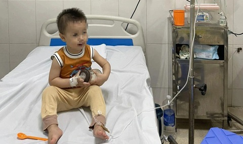Uống phải dầu hỏa, trẻ 20 tháng tuổi suy hô hấp: Cách sơ cứu khi ngộ độc hóa chất- Ảnh 1. Bé 20 tháng tuổi suy hô hấp do uống phải dầu hỏa - Ảnh BVCC