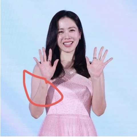 Nhiều cư dân mạng bất ngờ khi nhận thấy vết bầm tím trên cánh tay của Son Ye-jin Nhiều cư dân mạng bất ngờ khi nhận thấy vết bầm tím trên cánh tay của Son Ye-jin