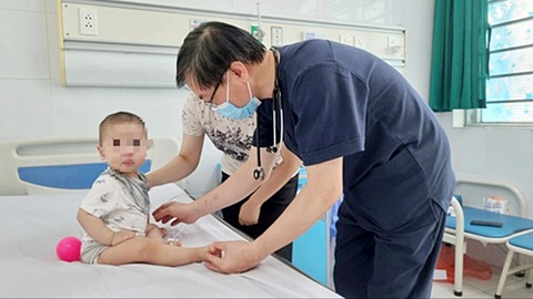 Cảnh báo bệnh tay chân miệng bước vào đỉnh dịch- Ảnh 1. Bác sĩ thăm khám cho bệnh nhi mắc tay chân miệng tại Bệnh viện Nhi trung ương - Ảnh: DƯƠNG LIỄU