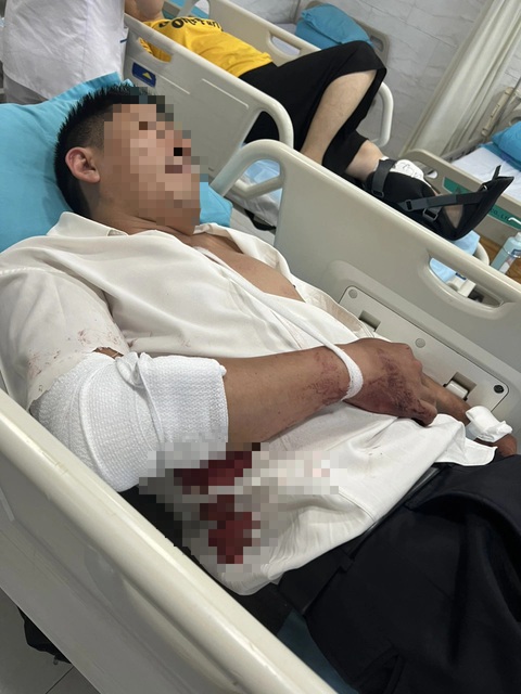 Thẩm phán ở Lâm Đồng bị trộm vào nhà chém trọng thương- Ảnh 1. Anh Võ Thành Luân - thẩm phán Tòa án nhân dân huyện Đơn Dương, tỉnh Lâm Đồng - bị trộm chém trọng thương - Ảnh: M.V.