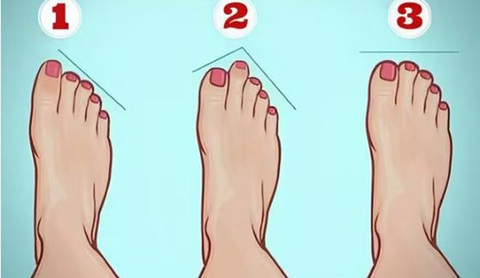 Bí mật tính cách ẩn giấu trong hình dáng bàn chân- Ảnh 1. Bí mật tính cách ẩn giấu trong hình dáng bàn chân- Ảnh 1.