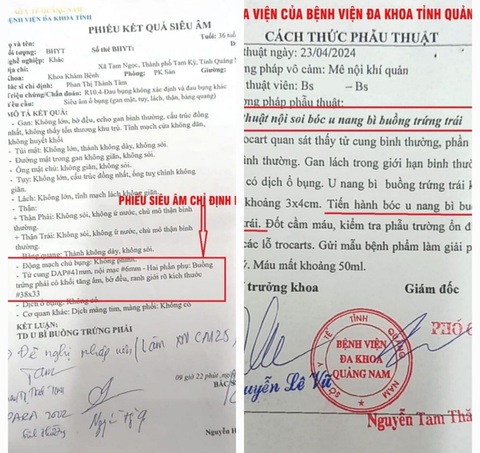 Quảng Nam báo cáo vụ chẩn đoán u nang bên phải, phẫu thuật bên trái: Khả năng u nang cả 2 bên- Ảnh 3. Kết quả siêu âm là u bì buồng trứng phải, còn hồ sơ ra viện ghi phẫu thuật nội soi bóc u nang bì buồng trứng trái - Ảnh: M.T.