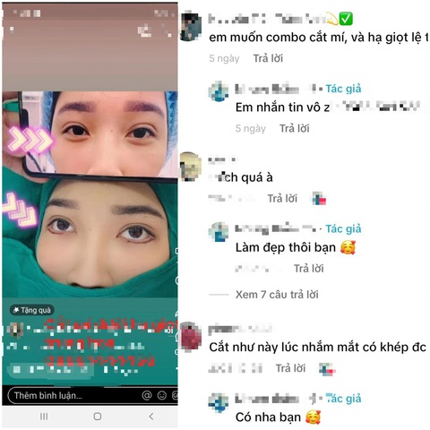 Bác sĩ cảnh báo nguy cơ biến chứng từ trào lưu thẩm mỹ ‘Hạ giọt lệ’- Ảnh 3. Các quảng cáo hạ giọt lệ thu hút được rất nhiều sự quan tâm, thích thú của các bạn trẻ - Ảnh: Chụp màn hình