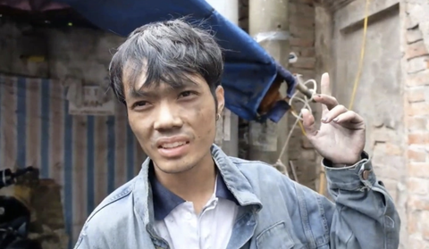 Những 'người hùng không mặc áo choàng' trong đời thực- Ảnh 2. Anh Nguyễn Đăng Văn sau vụ cháy tại Khương Hạ vào tháng 9-2023 - Ảnh: MINH HẢI