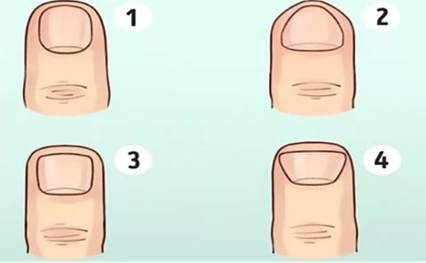 Dự đoán vận mệnh tài lộc của bạn qua hình dáng móng tay- Ảnh 1. Dự đoán vận mệnh tài lộc của bạn qua hình dáng móng tay- Ảnh 1.