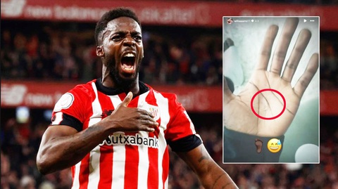 HLV cạn lời vì sao La Liga không biết bị thủy tinh găm chân 2 năm- Ảnh 1. Inaki Williams vẫn ra sân thường xuyên tại La Liga với mảnh thủy tinh ở bàn chân suốt 2 năm - Ảnh: Getty