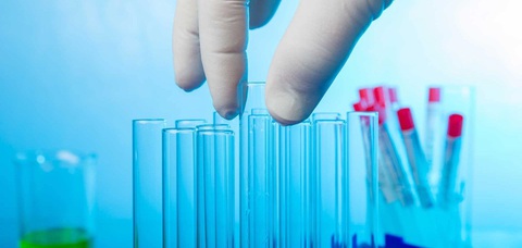 Trái ngọt từ những đột phá trong khoa học axit amin của Ajinomoto- Ảnh 1. Công nghệ AminoIndex® của Ajinomoto cho phép tầm soát sớm nguy cơ mắc ung thư chỉ với 5ml máu
